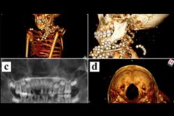 Un estudio internacional desvela la evolución en las prácticas de momificación infantil en el Antiguo Egipto