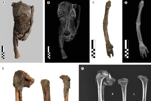 Artículo: Mummified proportionate dwarfs from the Valley of the Kings